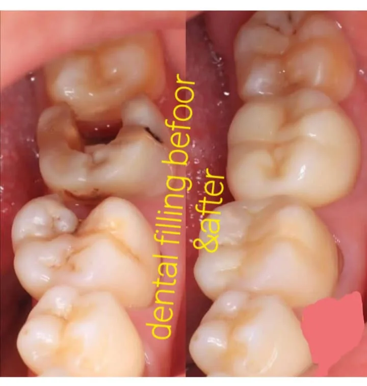 Alanya HEALTHY TEETH Dental Aesthetic — Medycyna w Alanyi: Zamówienie online, ceny i opinie