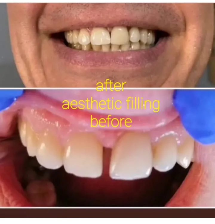 Alanya HEALTHY TEETH Dental Aesthetic — Medycyna w Alanyi: Zamówienie online, ceny i opinie