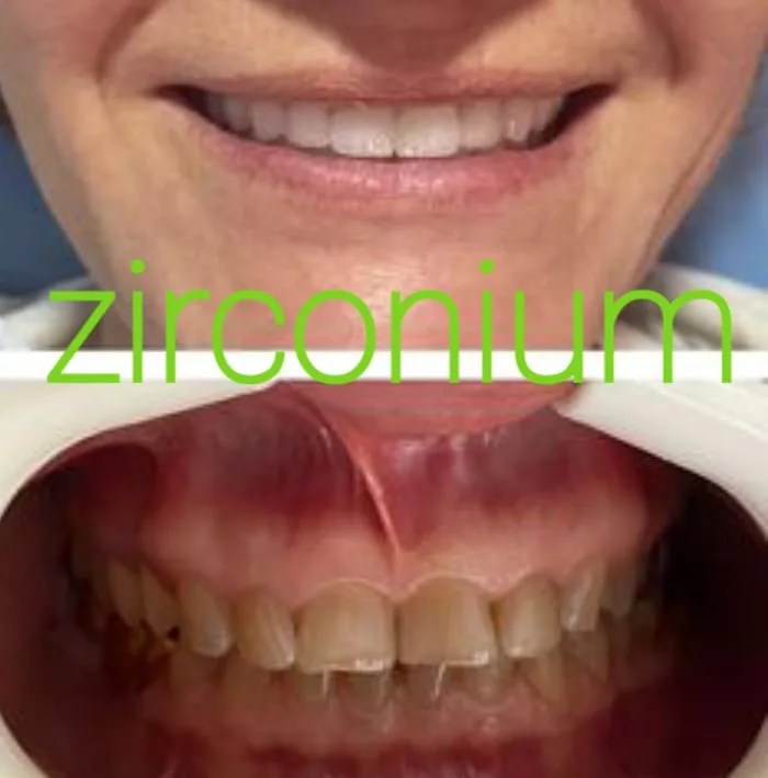 Alanya HEALTHY TEETH Dental Aesthetic — Medycyna w Alanyi: Zamówienie online, ceny i opinie