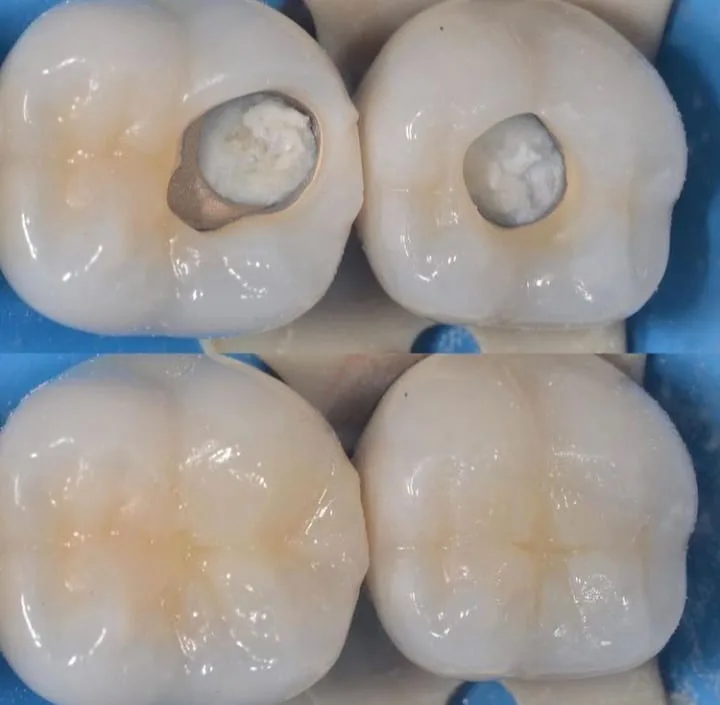 Alanya HEALTHY TEETH Dental Aesthetic — Medycyna w Alanyi: Zamówienie online, ceny i opinie