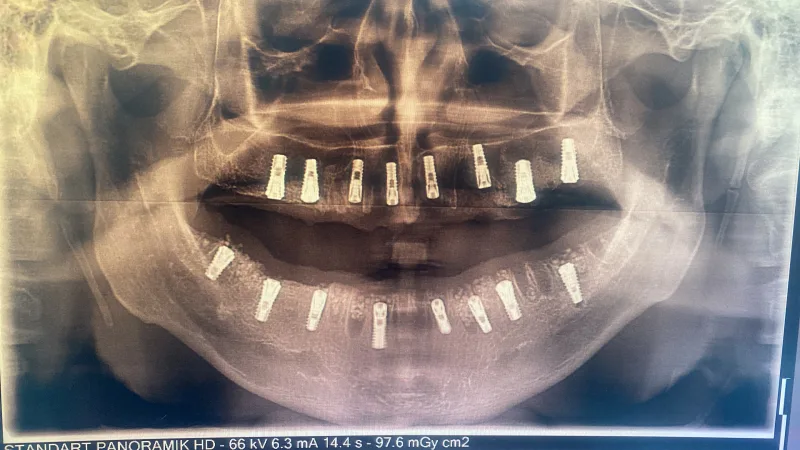 Alanya HEALTHY TEETH Dental Aesthetic — Medycyna w Alanyi: Zamówienie online, ceny i opinie