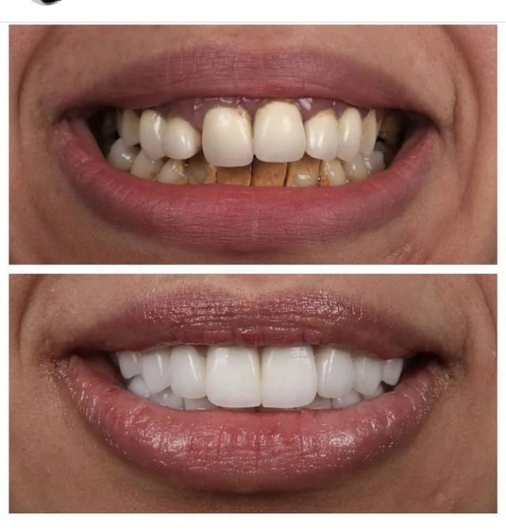 Alanya HEALTHY TEETH Dental Aesthetic — Medycyna w Alanyi: Zamówienie online, ceny i opinie