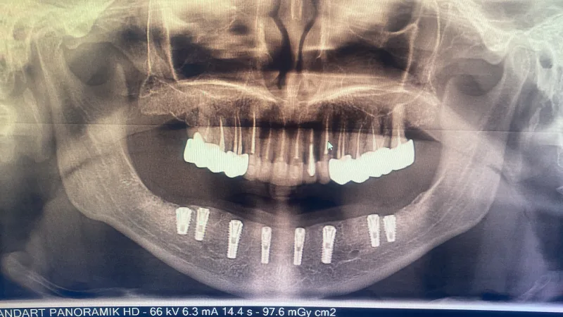 Alanya HEALTHY TEETH Dental Aesthetic — Medycyna w Alanyi: Zamówienie online, ceny i opinie