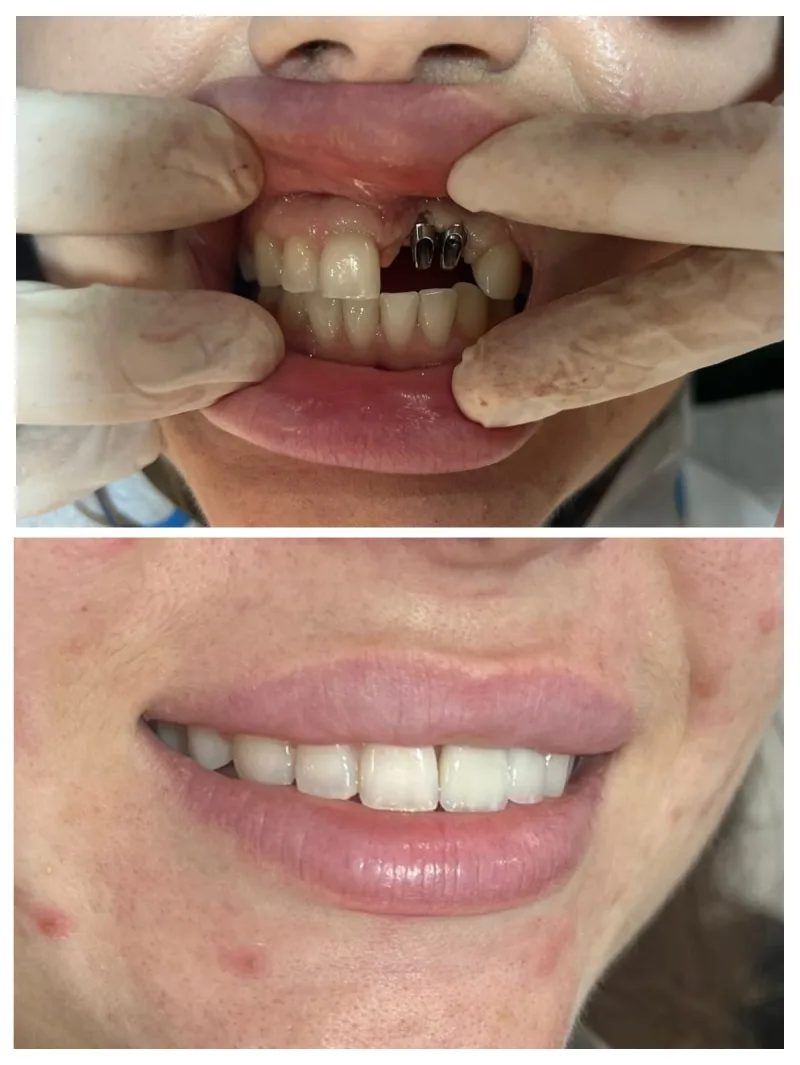 Alanya HEALTHY TEETH Dental Aesthetic — Medycyna w Alanyi: Zamówienie online, ceny i opinie