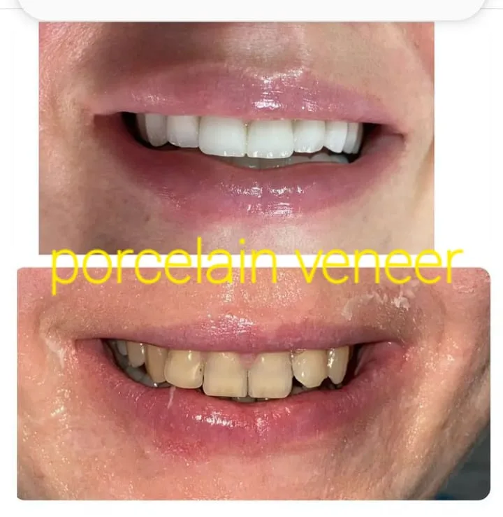 Alanya HEALTHY TEETH Dental Aesthetic — Medycyna w Alanyi: Zamówienie online, ceny i opinie