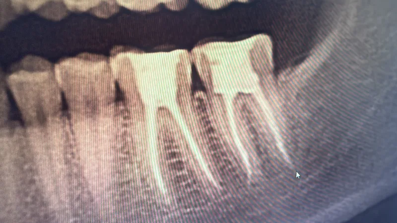 Alanya HEALTHY TEETH Dental Aesthetic — Medycyna w Alanyi: Zamówienie online, ceny i opinie
