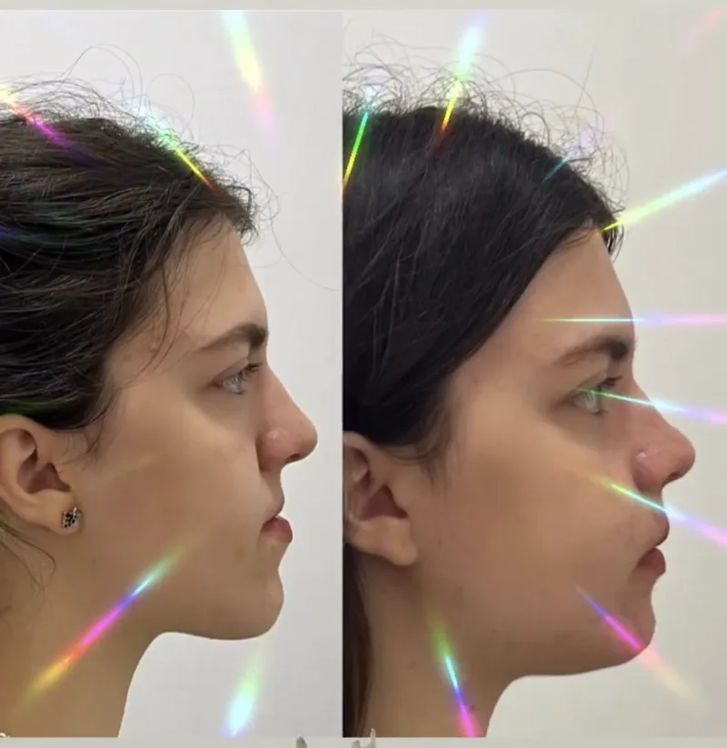 Alanya HEALTHY TEETH Dental Aesthetic — Medycyna w Alanyi: Zamówienie online, ceny i opinie